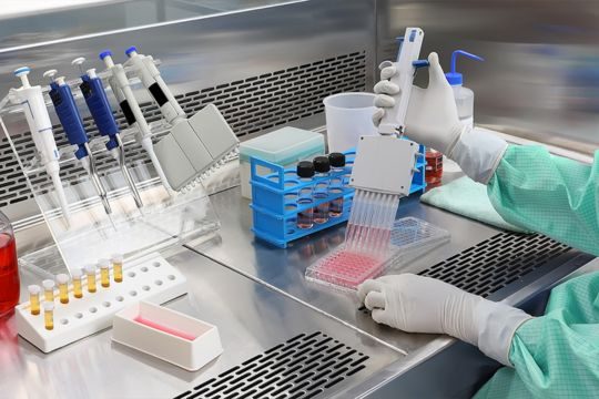 Top Considerations for Buying Hematology Analyzers